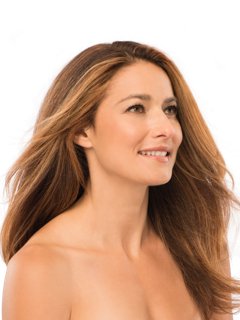 Mujer con piel más firme después de recibir Ultherapy